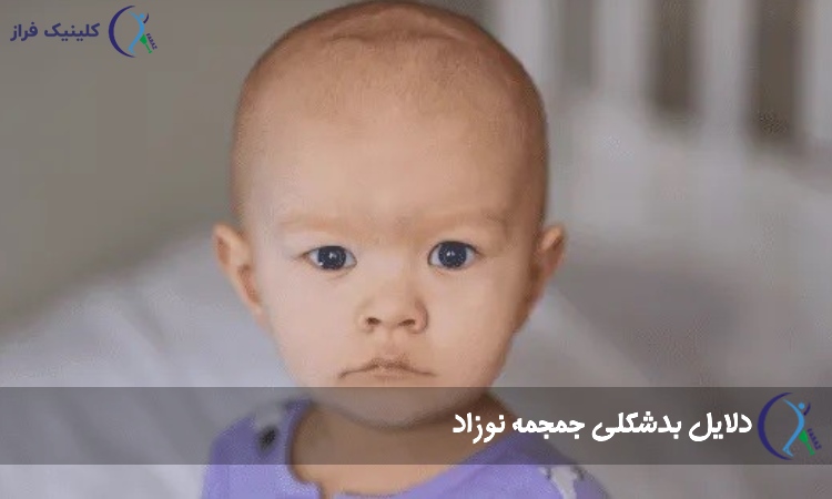 دلایل بدشکلی جمجمه نوزاد