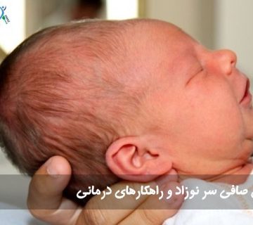 صافی سر نوزاد