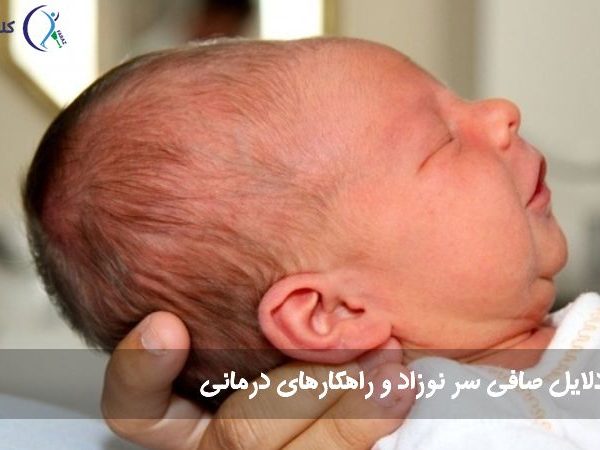 صافی سر نوزاد
