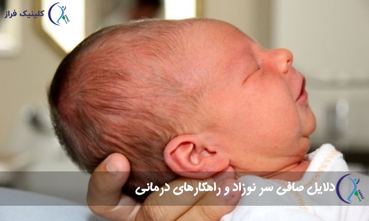 صافی سر نوزاد