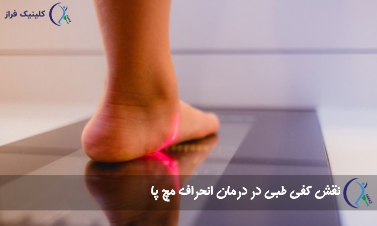 نقش کفی طبی در درمان انحراف مچ پا