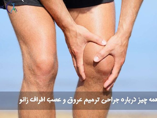 جراحی ترمیم عروق و عصب زانو
