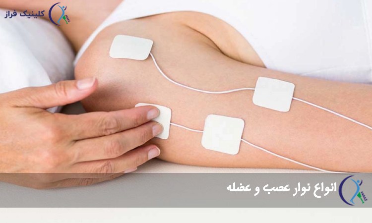 انواع نوار عصب و عضله