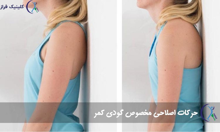 حرکات اصلاحی مخصوص گودی کمر