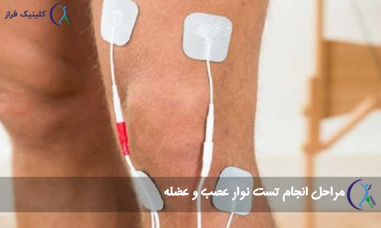 مراحل انجام تست نوار عصب و عضله
