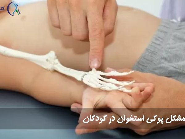 پوکی استخوان در کودکان
