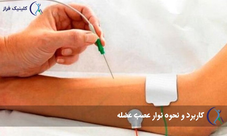 تست نوار عصب و عضله