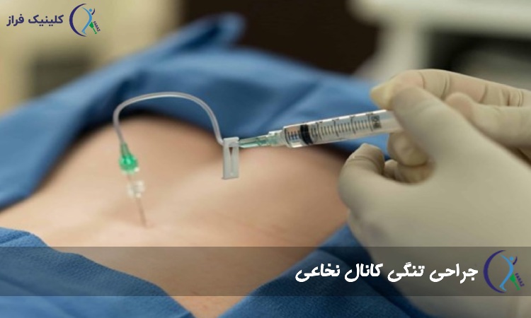 جراحی تنگی کانال نخاعی