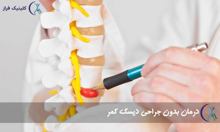 درمان بدون جراحی دیسک‌ کمر