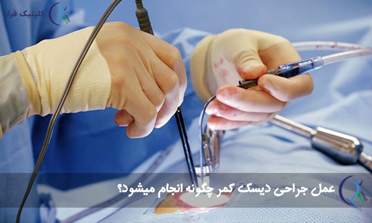 عمل جراحی دیسک کمر چگونه انجام میشود؟