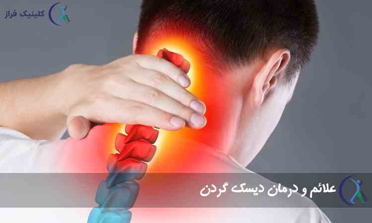گردن