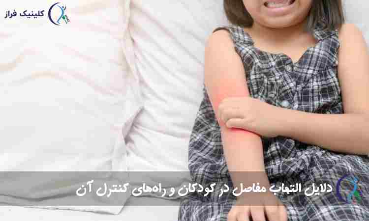 التهاب مفاصل در کودکان