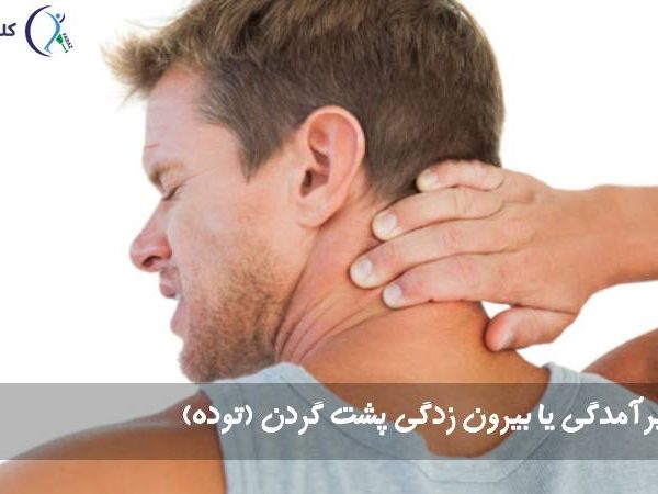 برآمدگی پشت گردن
