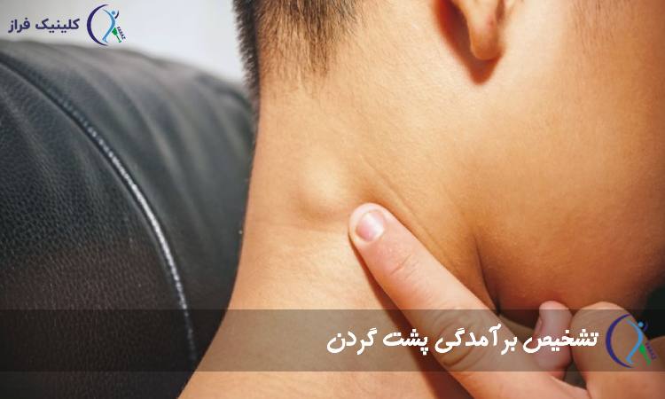 تشخیص برآمدگی پشت گردن