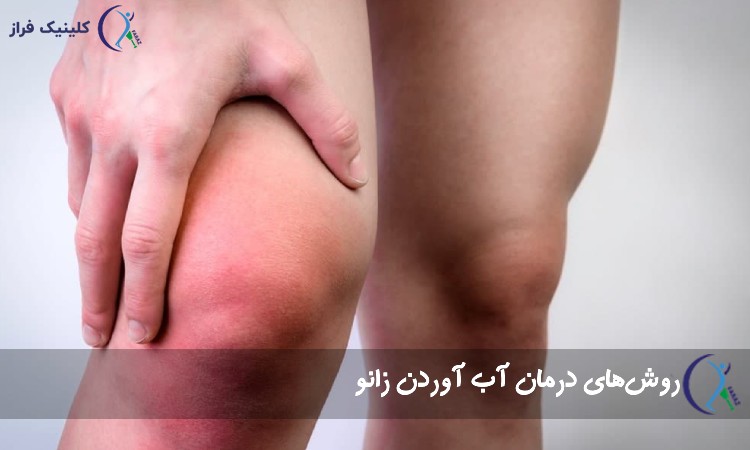 روش‌های درمان آب آوردن زانو