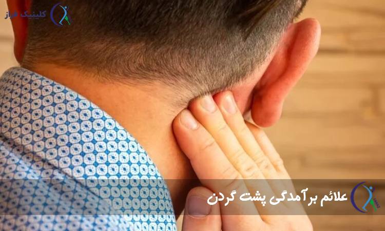 بیرون‌زدگی پشت گردن