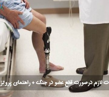 اقدامات لازم درصورت قطع عضو در جنگ + راهنمای پروتز مناسب