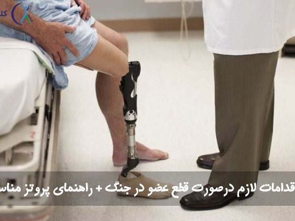 اقدامات لازم درصورت قطع عضو در جنگ + راهنمای پروتز مناسب