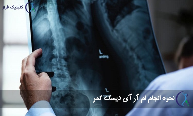 نحوه انجام ام آر آی دیسک کمر