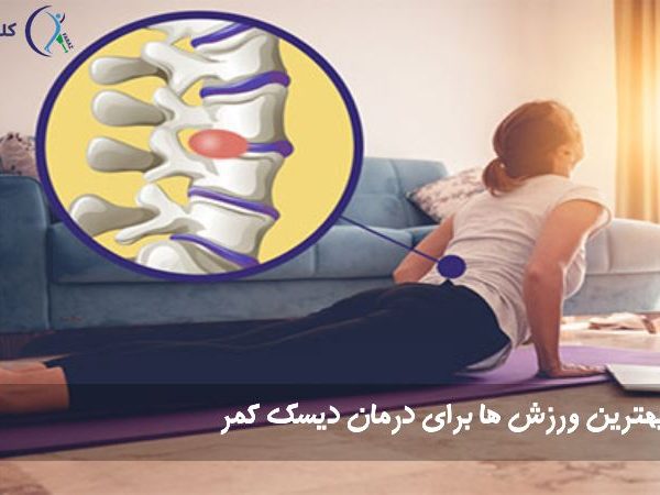 ورزش دیسک کمر 600x450