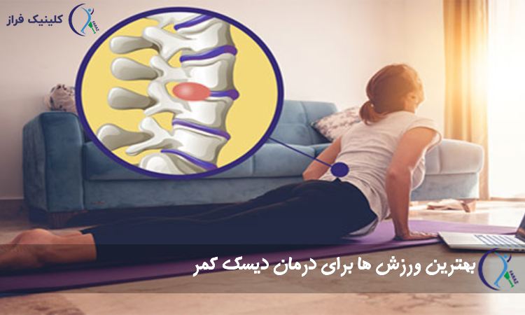 ورزش دیسک کمر