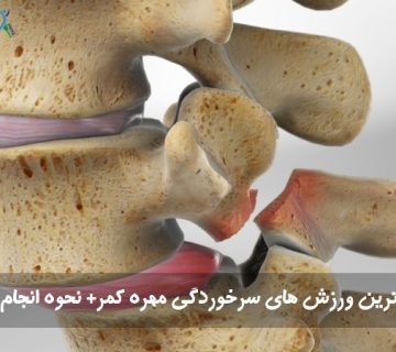ورزش سرخوردگی کمر