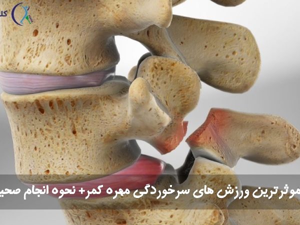 ورزش سرخوردگی کمر