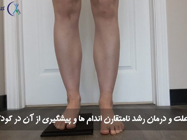 رشد نامتقارن اندام‌ ها در کودکان