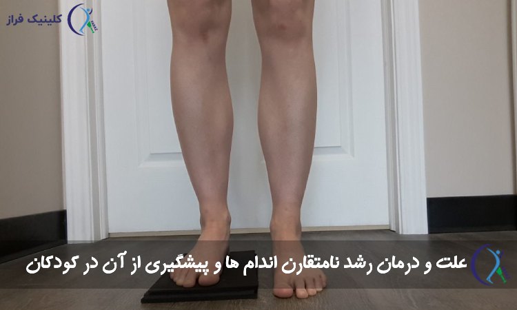 رشد نامتقارن اندام‌ ها در کودکان