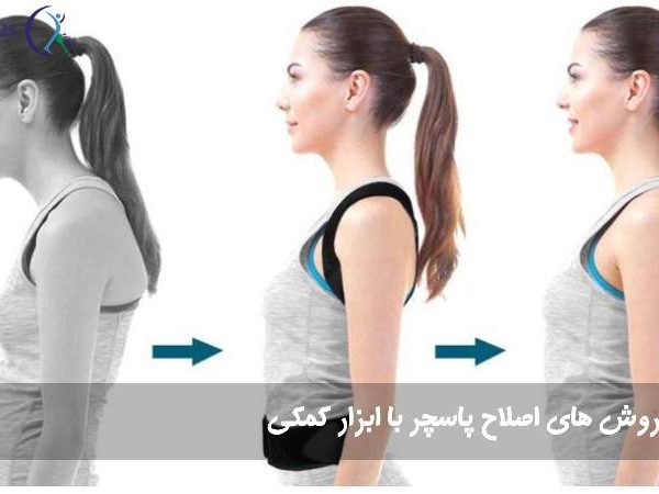 اصلاح پاسچر