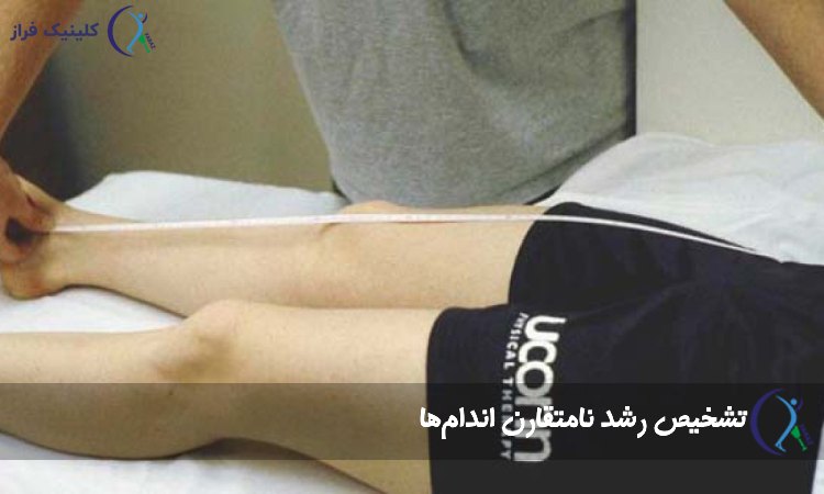 تشخیص رشد نامتقارن اندام‌ها