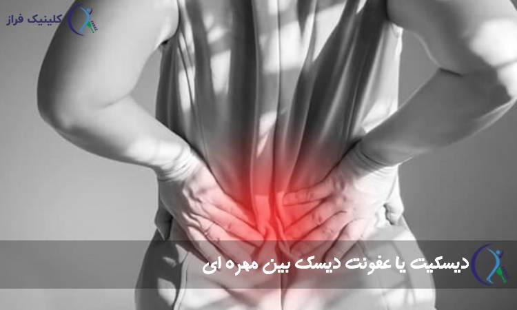 دیسکیت
