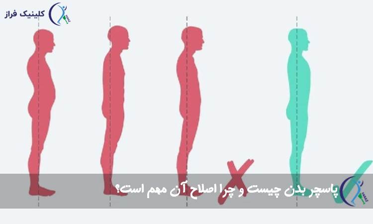 پاسچر بدن چیست