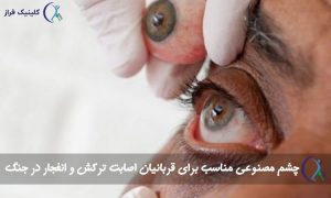 چشم مصنوعی برای قربانیان جنگ و موج انفجار
