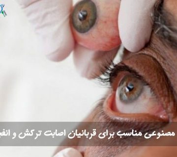 چشم مصنوعی برای قربانیان جنگ و موج انفجار