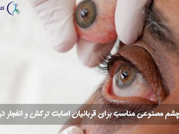چشم مصنوعی برای قربانیان جنگ و موج انفجار