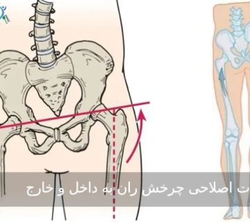 حرکات اصلاحی چرخش ران به داخل و خارج