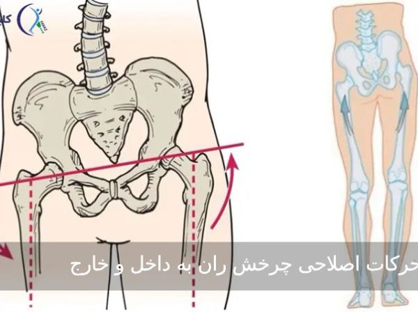 حرکات اصلاحی چرخش ران به داخل و خارج