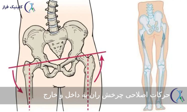 حرکات اصلاحی چرخش ران به داخل و خارج