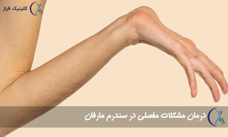 درمان مشکلات مفصلی در سندرم مارفان