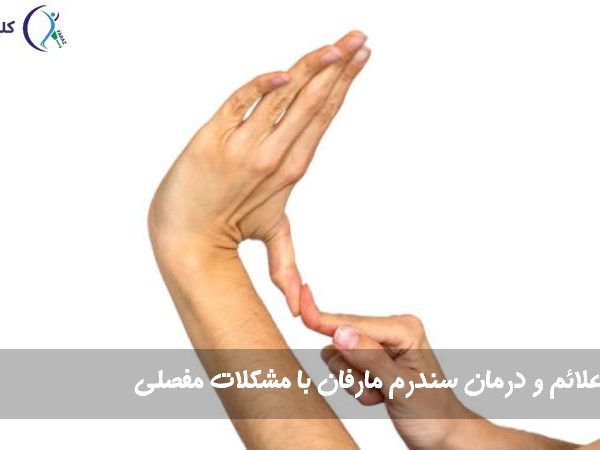 سندرم مارفان با مشکلات مفصلی