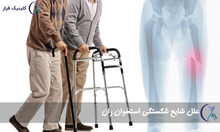 علل شایع شکستگی استخوان ران