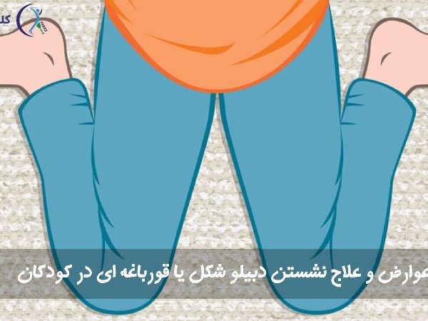 نشستن دبلیو شکل یا قورباغه‌ای