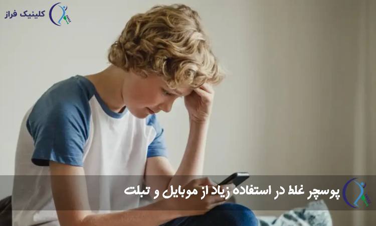 پوسچر غلط
