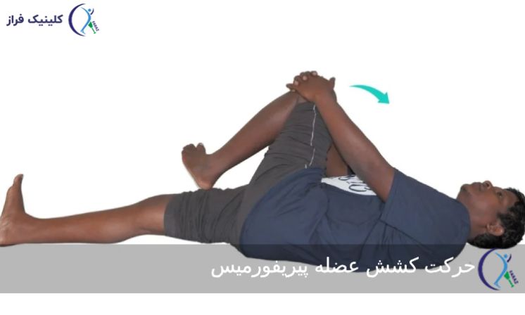 کشش عضله پیریفورمیس 