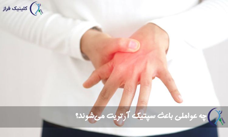 سپتیک آرتریت