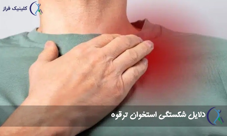 شکستگی ترقوه