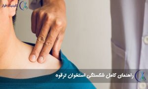 شکستگی ترقوه
