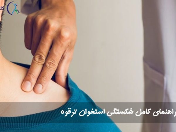 شکستگی ترقوه