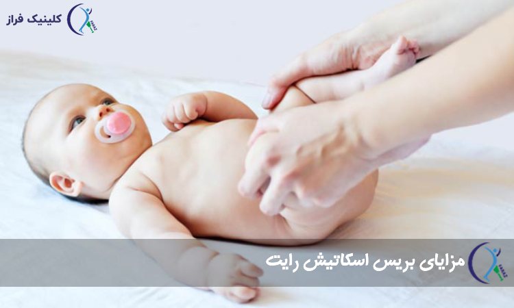 مزایای بریس اسکاتیش رایت